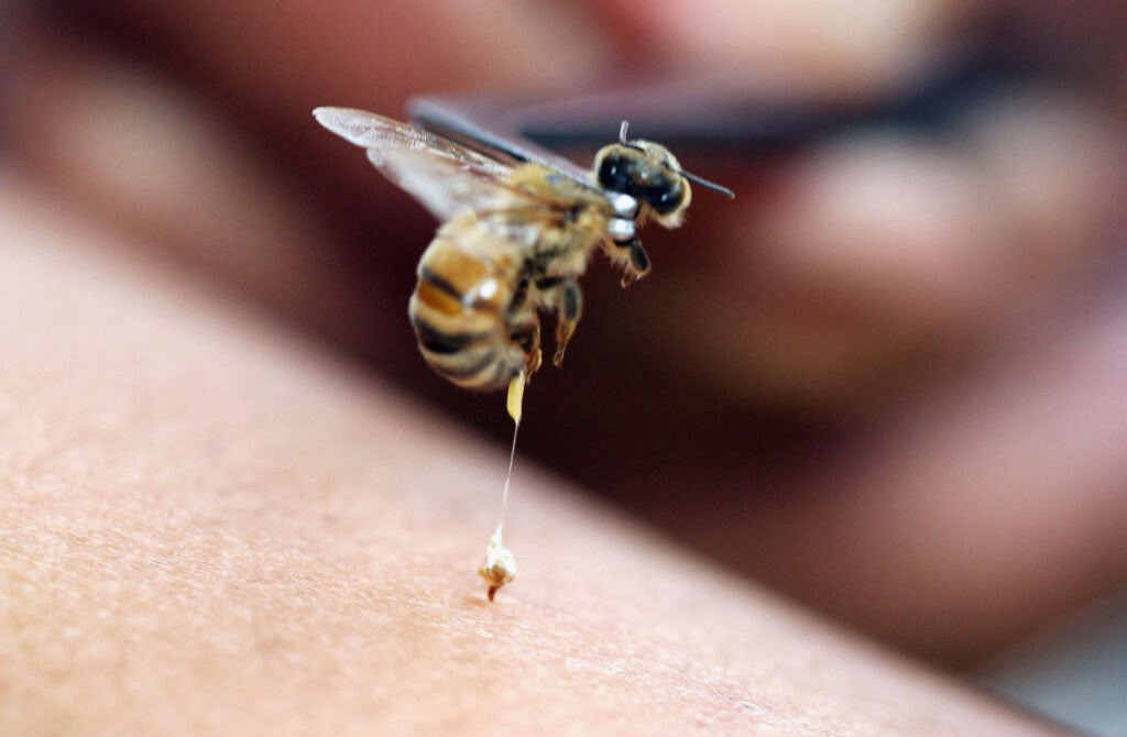Abeja utilizada en práctica complementaria de apiterapia
